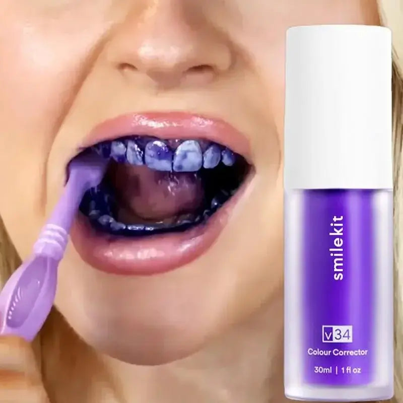 Dentes de Pérola – Clareador Profissional®️